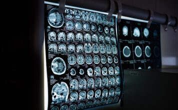Ile razy w roku można robić tomografię komputerową?