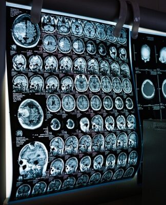 Czy można mieć pomalowane paznokcie na rezonans magnetyczny? Czy można mieć pomalowane paznokcie na rezonans magnetyczny?