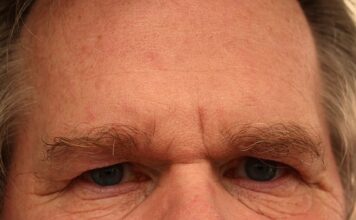 Jakie są główne rodzaje konfliktów?